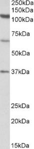 EB11290 (1 µg/ml) staining of Human Testis lysate (35 µg protein in RIPA buffer). Primary incubation was 1 hour. Detected by chemiluminescence.