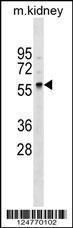 Anti-GLT11 Rabbit Polyclonal Antibody (AP (Alkaline Phosphatase))