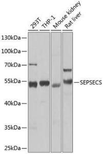 Western blot analysis of extracts of various cell lines, using Anti-SEPSECS Antibody (A10058) at 1:1,000 dilution The secondary antibody was Goat Anti-Rabbit IgG H&L Antibody (HRP) at 1:10,000 dilution Lysates/proteins were present at 25 µg per lane