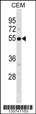 Anti-RBBP7 Rabbit Polyclonal Antibody