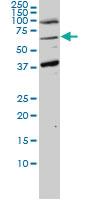 Anti-ASPSCR1 Mouse Monoclonal Antibody [clone: 3D10-1D11]