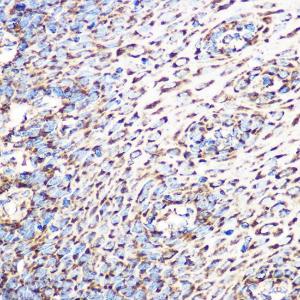 Immunohistochemistry analysis of paraffin-embedded human esophageal using Anti-GLUD1 Antibody [ARC1216] (A305787) at a dilution of 1:100 (40X lens). Perform microwave antigen retrieval with 10 mM Tris/EDTA buffer pH 9.0 before commencing with IHC staining protocol