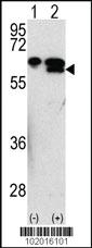 Anti-MMP3 Rabbit Polyclonal Antibody