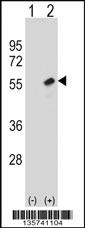 Anti-RBBP7 Rabbit Polyclonal Antibody