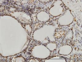 Anti-SFPQ Mouse Monoclonal Antibody [clone: 6D7]