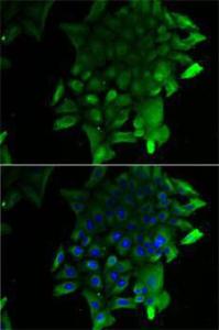 Immunofluorescence analysis of U2OS cells using Anti-SEPSECS Antibody (A10058) DAPI was used to stain the cell nuclei (blue)