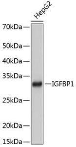 Western blot analysis of extracts of HepG2 cells, using Anti-IGFBP1 Antibody [ARC0671] (A80700) at 1:1000 dilution. The secondary Antibody was Goat Anti-Rabbit IgG H&L Antibody (HRP) at 1:10000 dilution. Lysates/proteins were present at 25 µg per lane