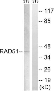 Western blot analysis of lysates from NIH/3T3 cells, treated with starved 24h using Anti-RAD51 Antibody. The right hand lane represents a negative control, where the antibody is blocked by the immunising peptide