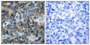 Immunohistochemical analysis of paraffin-embedded human tonsil using Anti-VASP (phospho Ser238) Antibody. The right hand panel represents a negative control, where the antibody was pre-incubated with the immunising peptide