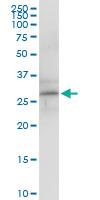 Anti-RGS5 Polyclonal Antibody Pair