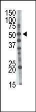 Anti-GCNT1 Rabbit Polyclonal Antibody (Biotin)