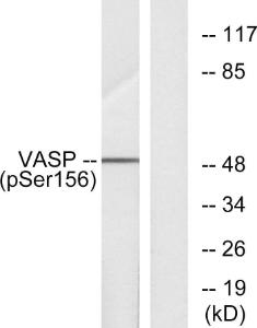 Antibody anti-VASP phospho SER157 100 µg