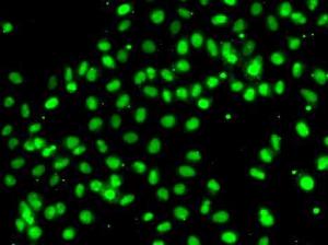 Immunofluorescence analysis of A549 cells using Anti-MEPCE Antibody (A7121)