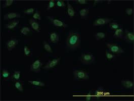 Anti-SFPQ Mouse Monoclonal Antibody [clone: 6D7]