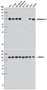 Anti-Caldesmon-1 Rabbit Monoclonal Antibody [clone: 13G23]