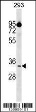 Anti-CIAPIN1 Rabbit Polyclonal Antibody (PE (Phycoerythrin))