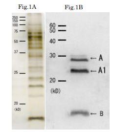 Anti-Cholera Toxin Antibod