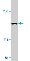 Anti-MAP3K5 Rabbit Polyclonal Antibody