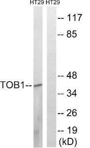 Western blot analysis of lysates from HT29 cells treated with serum 20% 15' using Anti-TOB1 (phospho Ser164) Antibody The right hand lane represents a negative control, where the antibody is blocked by the immunising peptide