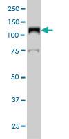 Anti-LIG1 Mouse Monoclonal Antibody [clone: 10G12]