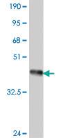 Anti-IL17RB Mouse Polyclonal Antibody