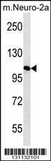 Anti-MAN2A2 Rabbit Polyclonal Antibody (Biotin)