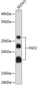 Western blot analysis of extracts of SKOV3 cells, using Anti-FGF2 Antibody [ARC0618] (A308407) at 1:1,000 dilution The secondary antibody was Goat Anti-Rabbit IgG H&L Antibody (HRP) at 1:10,000 dilution Lysates/proteins were present at 25 µg per lane