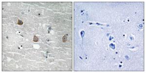 Immunohistochemical analysis of paraffin-embedded human brain using Anti-TOB1 (phospho Ser164) Antibody The right hand panel represents a negative control, where the antibody was pre-incubated with the immunising peptide