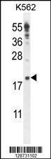 Anti-IQCJ Rabbit Polyclonal Antibody (Biotin)