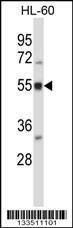 Anti-BAIAP2L2 Rabbit Polyclonal Antibody (Biotin)