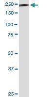 Anti-MYH9 Mouse Monoclonal Antibody [clone: 2B3]