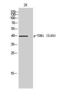 Western blot analysis of JK cells using Anti-TOB1 (phospho Ser164) Antibody