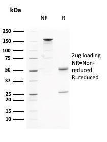 SDS-PAGE analysis of Anti-AKT1 Antibody [AKT1/2784] under non-reduced and reduced conditions; showing intact IgG and intact heavy and light chains, respectively. SDS-PAGE analysis confirms the integrity and purity of the antibody.