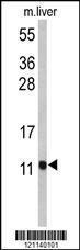 Anti-PCBD1 Rabbit Polyclonal Antibody (FITC (Fluorescein Isothiocyanate))