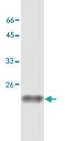 Anti-SOD1 Mouse Monoclonal Antibody [clone: 18]