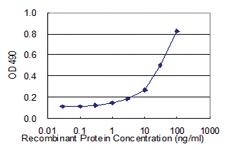 Anti-AHNAK Polyclonal Antibody Pair