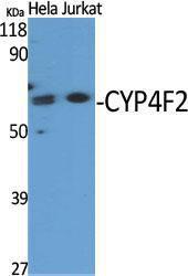 Western blot analysis of various cells using Anti-Cytochrome P450 4F2 Antibody