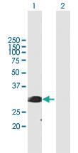 Anti-SRSF1 Mouse Polyclonal Antibody