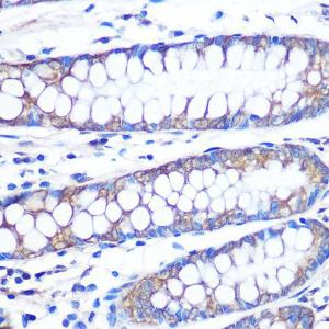 Immunohistochemistry analysis of paraffin-embedded human colon tissue using Anti-FGF2 Antibody [ARC0618] (A308407) at a dilution of 1:100 (40x lens) Perform microwave antigen retrieval with 10 mM PBS buffer pH 72 before commencing with IHC staining protocol