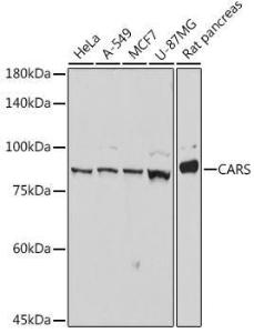 Western blot analysis of extracts of various cell lines, using Anti-CARS Antibody [ARC2504] (A305788) at 1:1,000 dilution. The secondary antibody was Goat Anti-Rabbit IgG H&L Antibody (HRP) at 1:10,000 dilution.