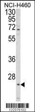 Anti-ALG14 Rabbit Polyclonal Antibody (APC (Allophycocyanin))