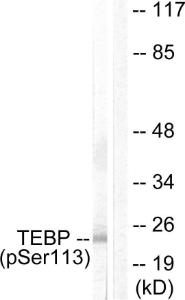 Anti-p23 Rabbit Polyclonal Antibody