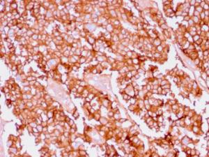 Immunohistochemical analysis of formalin-fixed, paraffin-embedded human ovary using Anti-EpCAM Antibody [EGP40/1556R]