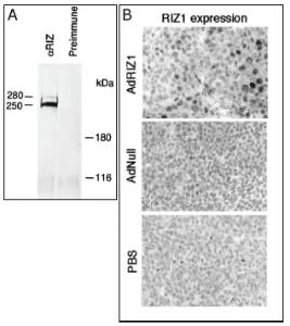 Anti-PRDM2 (RIZ1) Rabbit Polyclonal Antibody