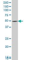 Anti-PAX8 Mouse Monoclonal Antibody [clone: 3H7]