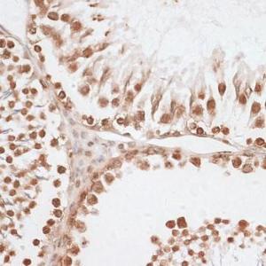 Immunohistochemistry analysis of paraffin-embedded rat testis using Anti-Histone H2A.X Antibody (A80779) at a dilution of 1:100 (40X lens). Perform microwave antigen retrieval with 10 mM PBS buffer pH 7.2 before commencing with IHC staining protocol