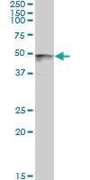 Anti-PAX8 Mouse Monoclonal Antibody [clone: 3H7]