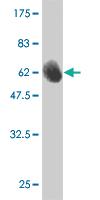 Anti-FBL Mouse Monoclonal Antibody [clone: 4G9-E4]