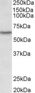 EB11387 (0.1 µg/ml) staining of Human Thymus lysate (35 µg protein in RIPA buffer). Primary incubation was 1 hour. Detected by chemiluminescence.