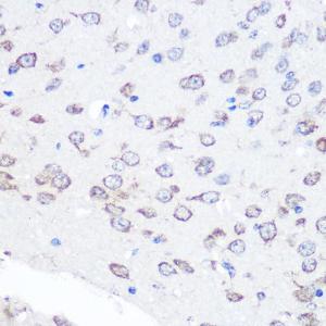 Immunohistochemistry analysis of paraffin-embedded mouse brain using Anti-FGF2 Antibody [ARC0618] (A308407) at a dilution of 1:100 (40x lens) Perform microwave antigen retrieval with 10 mM PBS buffer pH 72 before commencing with IHC staining protocol